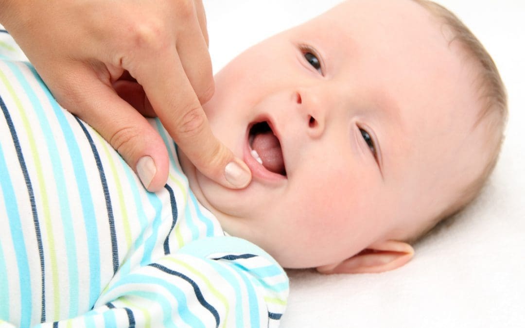 Does Tooth Decay in Baby Teeth Affect Permanent Teeth?