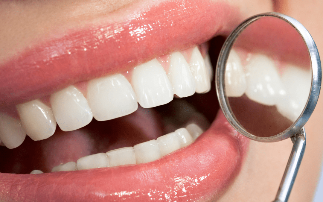 teeth cleaning. use your private health benefits before the year ends