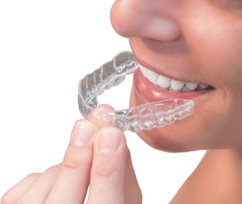 Achieve a Beautiful Smile on a Budget with Invisalign